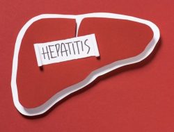 Pemerintah Optimal Menghadapi Kasus Hepatitis Akut